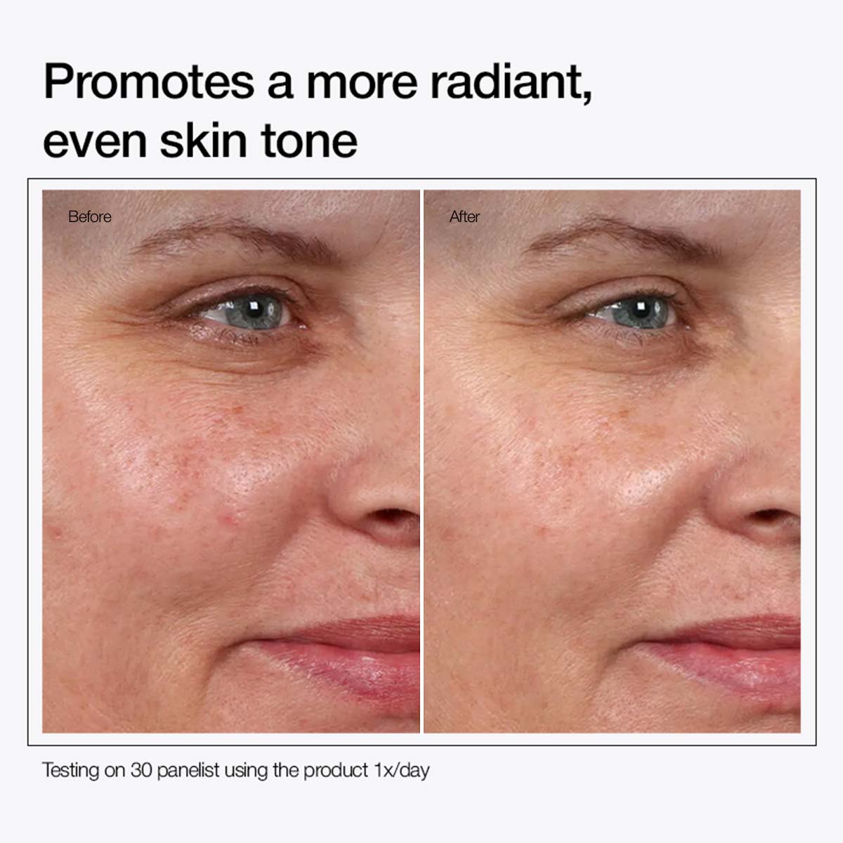 Urapra Glycolic Acid 7% Face Toner – Brightens, Smooths & Fades Dark Spots