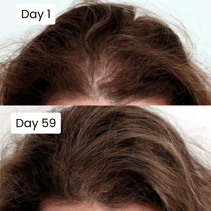 Scalp Hair Growth Serum – Nourishing Hair & Scalp Care Formula